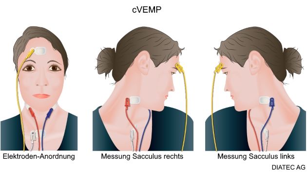 cvemp_elektroden_de_kl