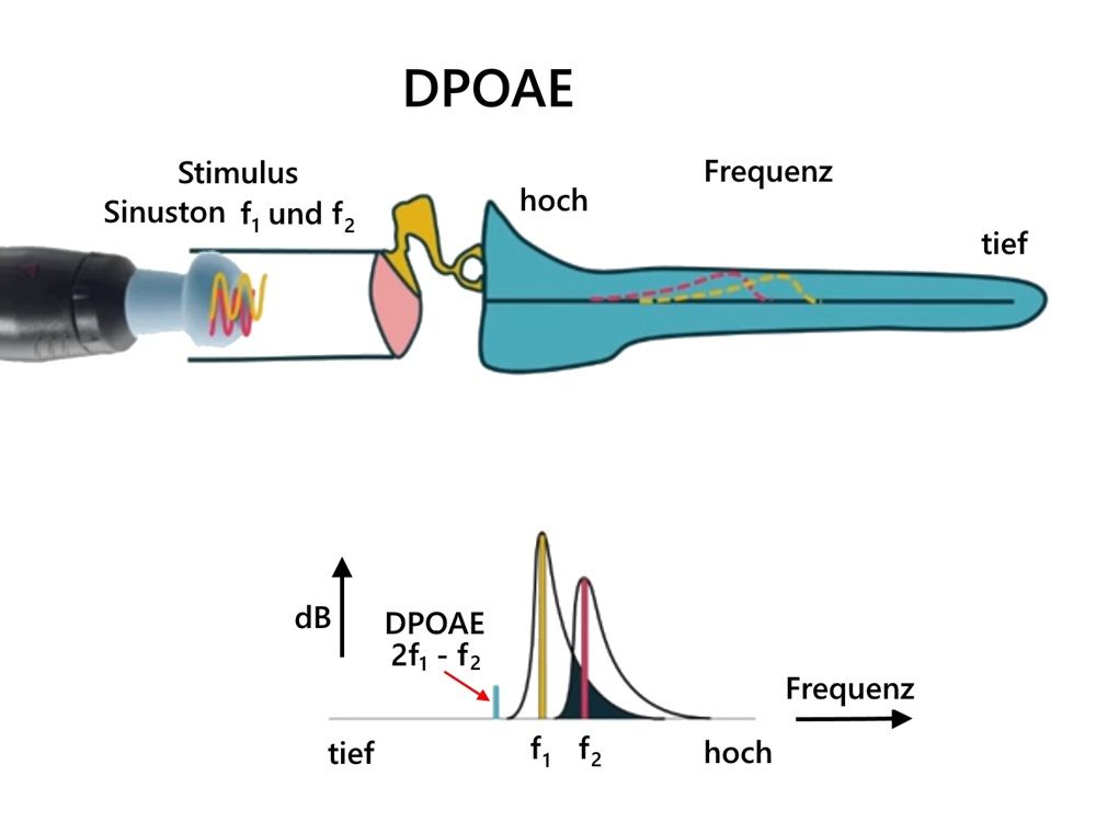 dpoae_messprinzip_flach.jpg