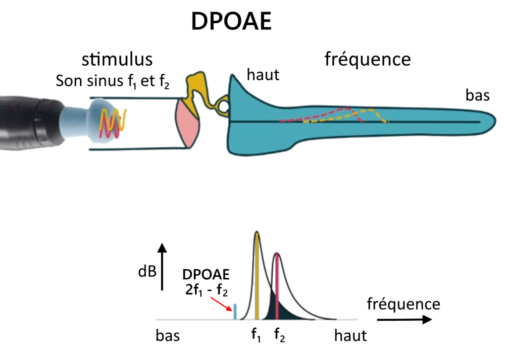 dpoae