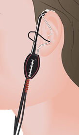 insitu-messung_versorgt