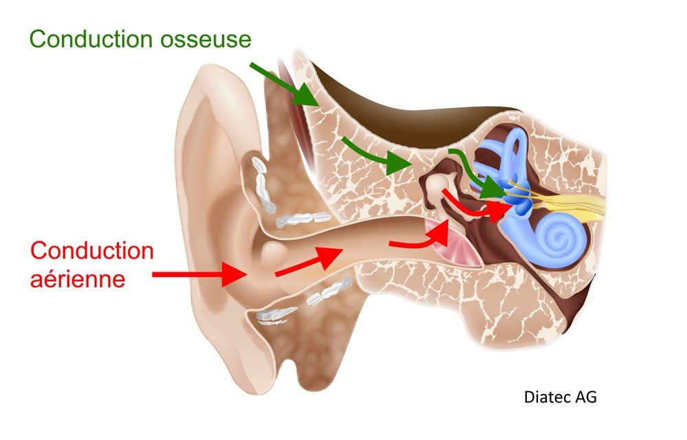 oreillecoupurellklfr