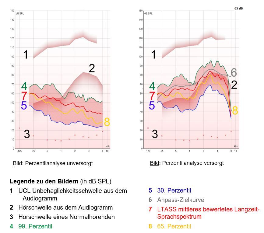 perzentilanalyse_beispiel