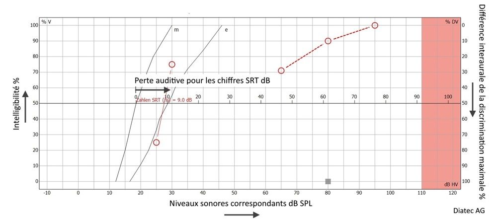sprachaudiogramm_beschriftung_fr