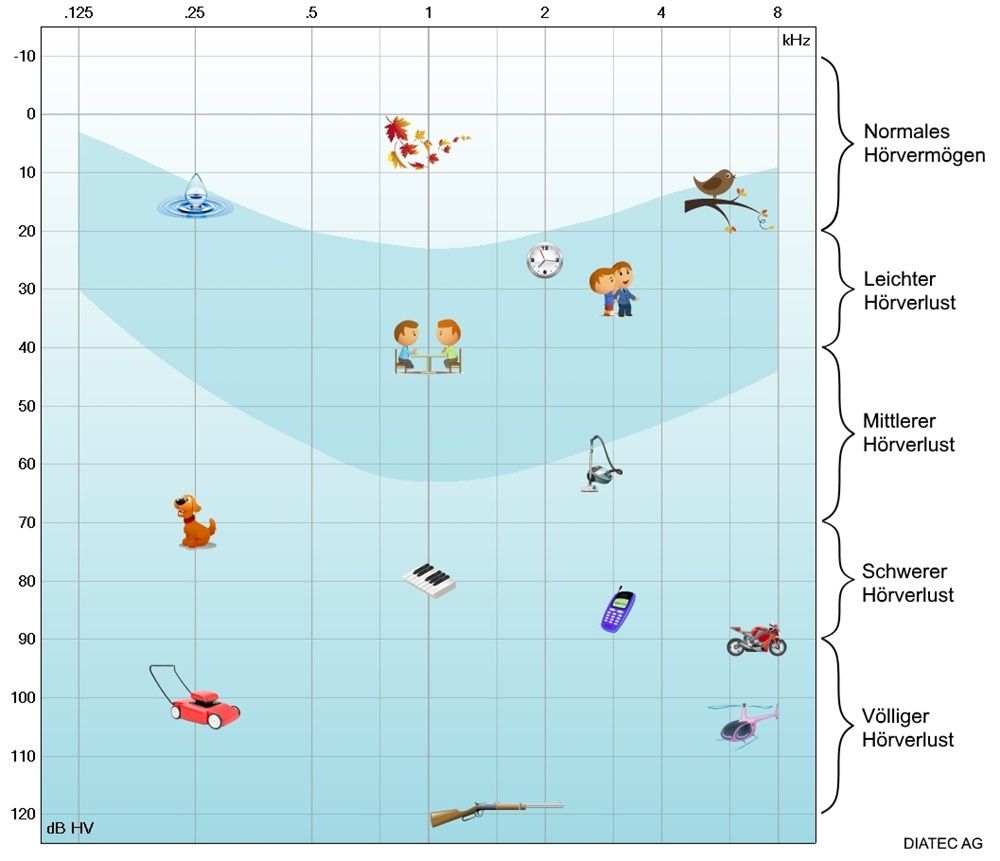 tonaudiogramm_schweregrad_sprachbanane_de_kl.jpg