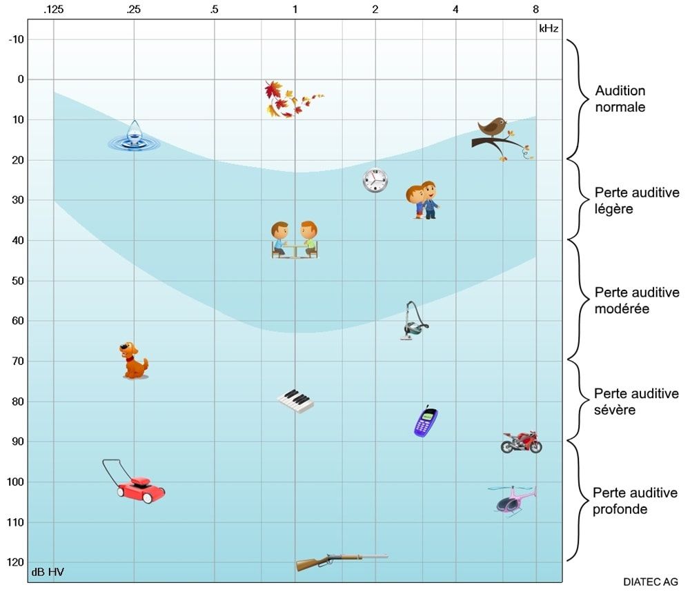 tonaudiogramm_schweregrad_sprachbanane_fr