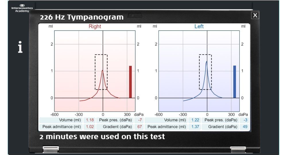 xvirtuelle_klinik_tymp.jpg,qla=de-ch,arev=29B2,ahash=7541469931EE849178DDBD517009ADF8.pagespeed.ic.vOieKVnuE9.jpg